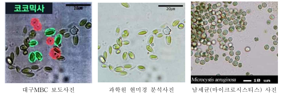 현미경사진